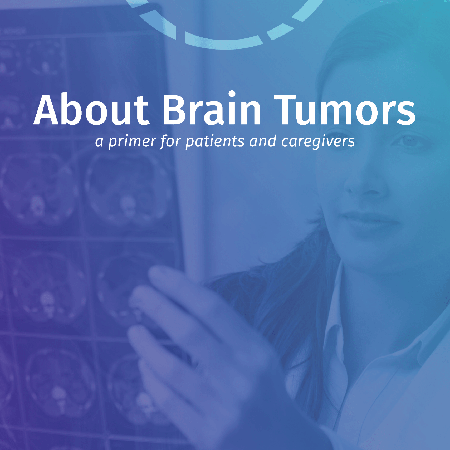 About Brain Tumors: A Primer for Patients & Caregivers