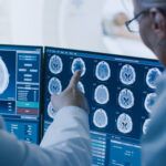 Brain tumor scans in lab with doctors pointing