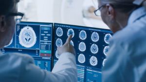 Brain tumor scans in lab with doctors pointing